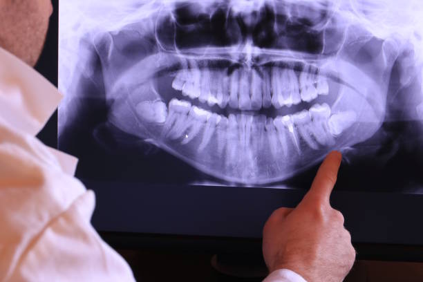 Best Emergency Dental Care for Broken or Chipped Teeth in Morehead, KY