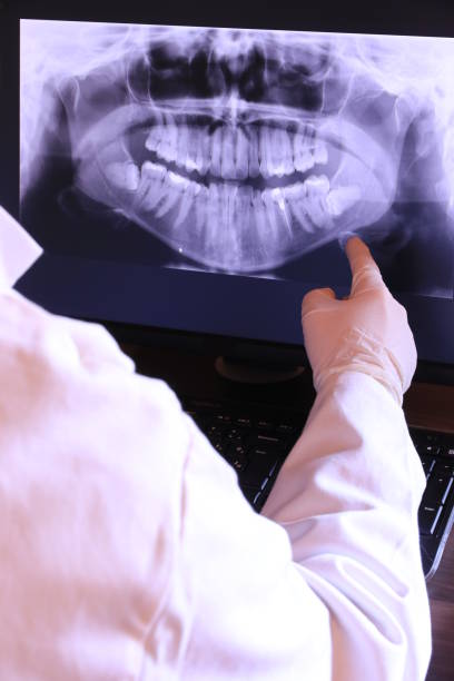 Best Emergency Treatment for Dental Infections or Abscesses in Morehead, KY