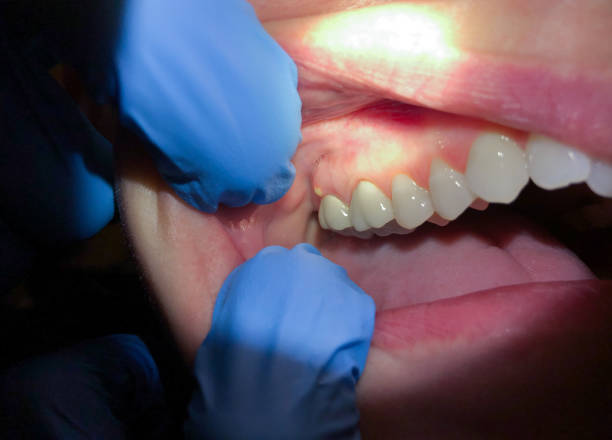 Best Pediatric Emergency Dentist in Morehead, KY